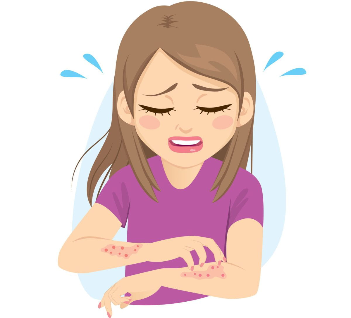 Young,Woman,Scratching,Arms,Suffering,Strong,Allergy,Skin,Itchy,Symptom Young,Woman,Scratching,Arms,Suffering,Strong,Allergy,Skin,Itchy,Symptom